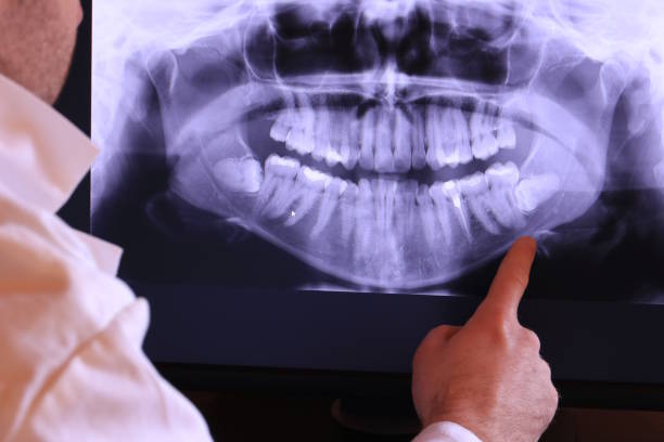 Best Emergency Dentist for Knocked-Out Tooth in Plumsteadville, PA