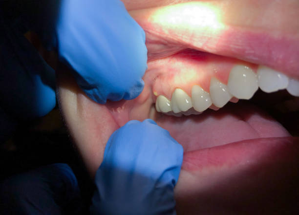 Best Weekend Emergency Dentist in Plumsteadville, PA